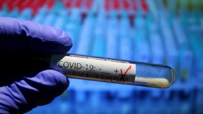 От направените тестове 314 PCR, а 2 526 са бързите антигенни тестове. Снимката е илюстративна