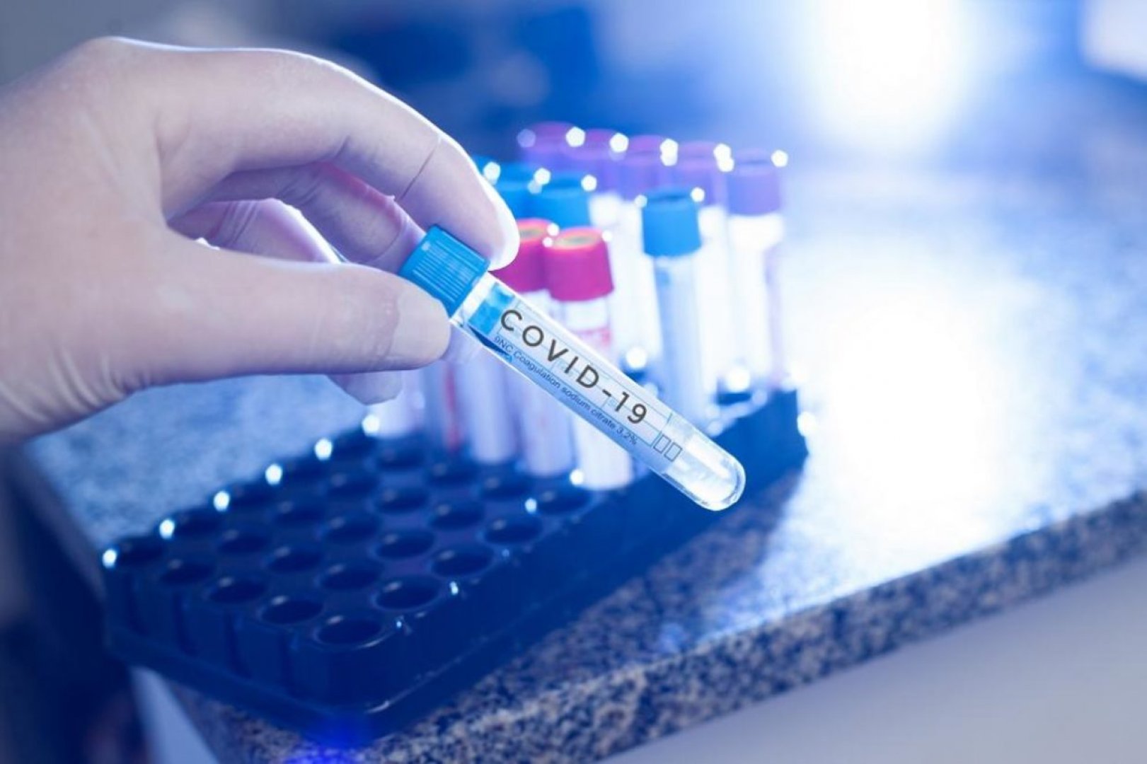 Потвърдените случаи чрез PCR теста са 851 броя, а чрез бърз антигенен тест - 1 167. Снимката е илюстративна