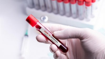 Над 8000 PCR и бързи антигенни тестове са направени за изминалото денонощие. Снимката е илюстративна