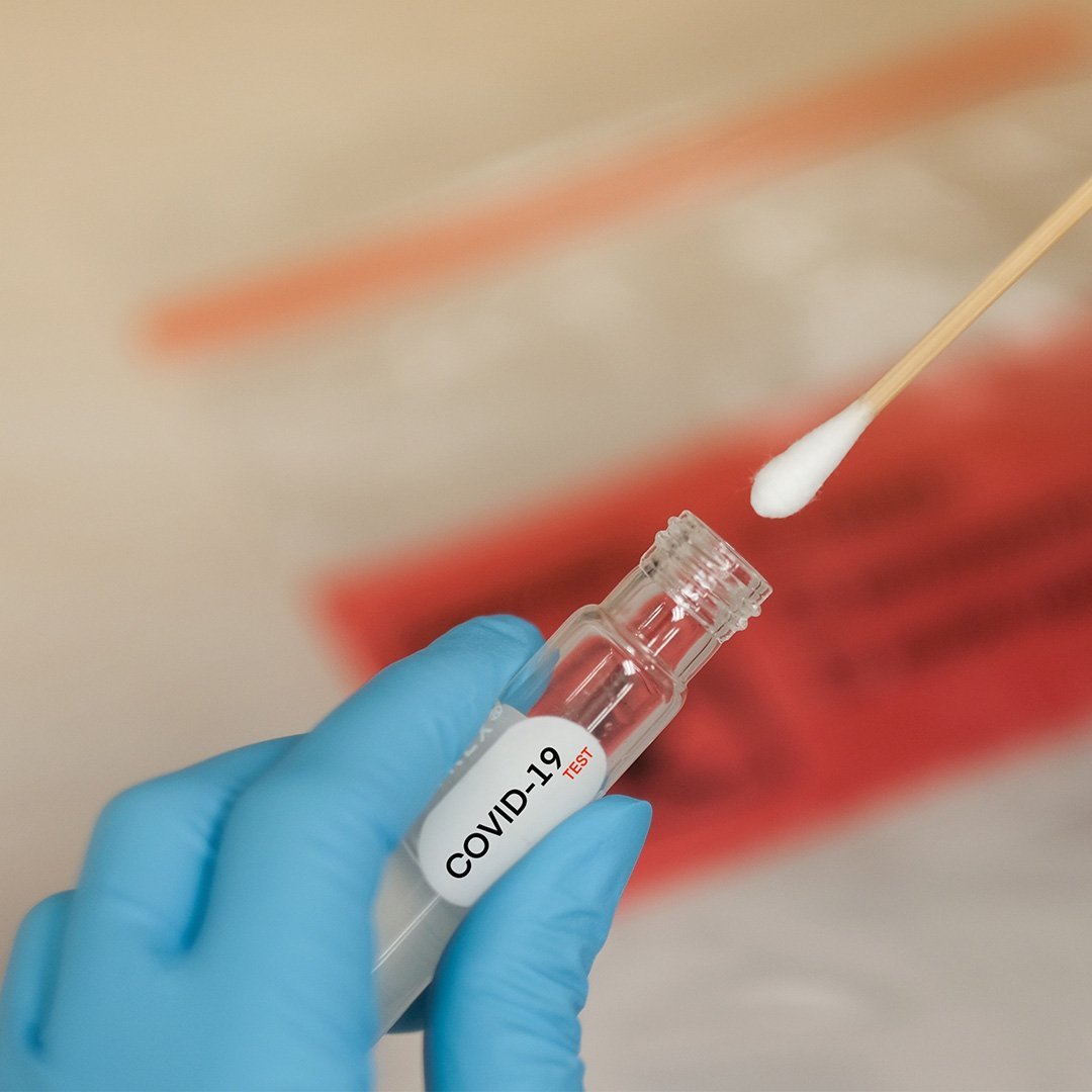От направените тестове 1 443 PCR, а 8 568 са бързите антигенни тестове. Снимката е илюстративна