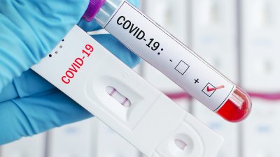 Общо за област Бургас от началото на пандемията до днес са регистрирани 57 341 положителни проби за COVID-19. Снимката е илюстративна