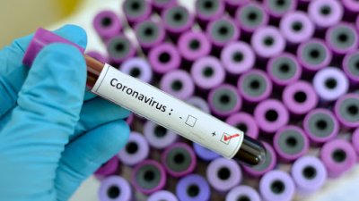 Положителните проби за корона вирусна инфекция в Бургас и областта достигнаха 1 016 случая. Снимката е илюстративна